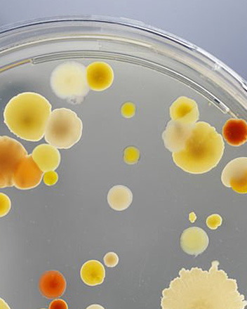 Close-up view of diverse bacterial and fungal colonies in various shades of yellow, orange, and tan growing on an agar plate.
